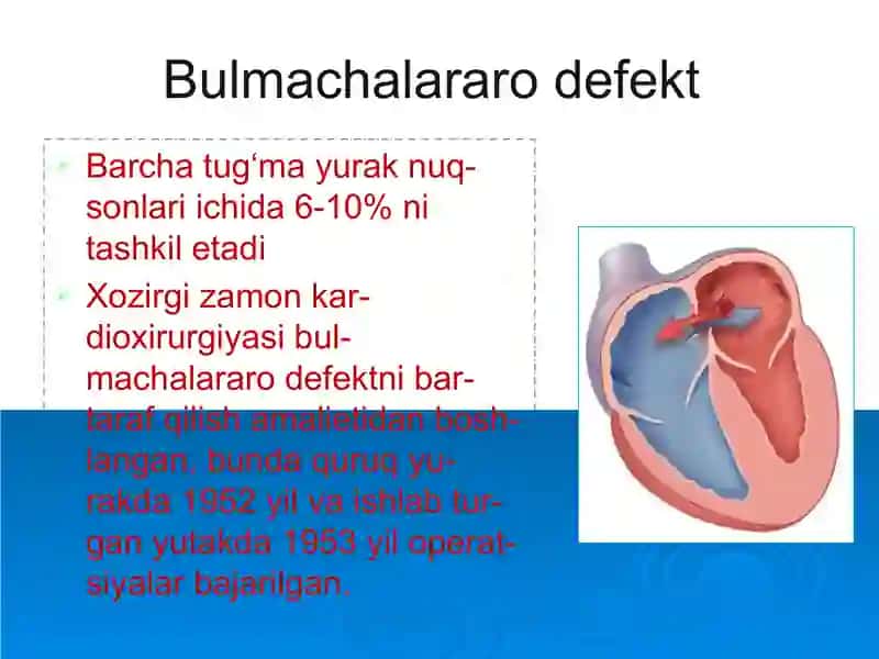 Tug‘ma yurak nuqsonlari 3