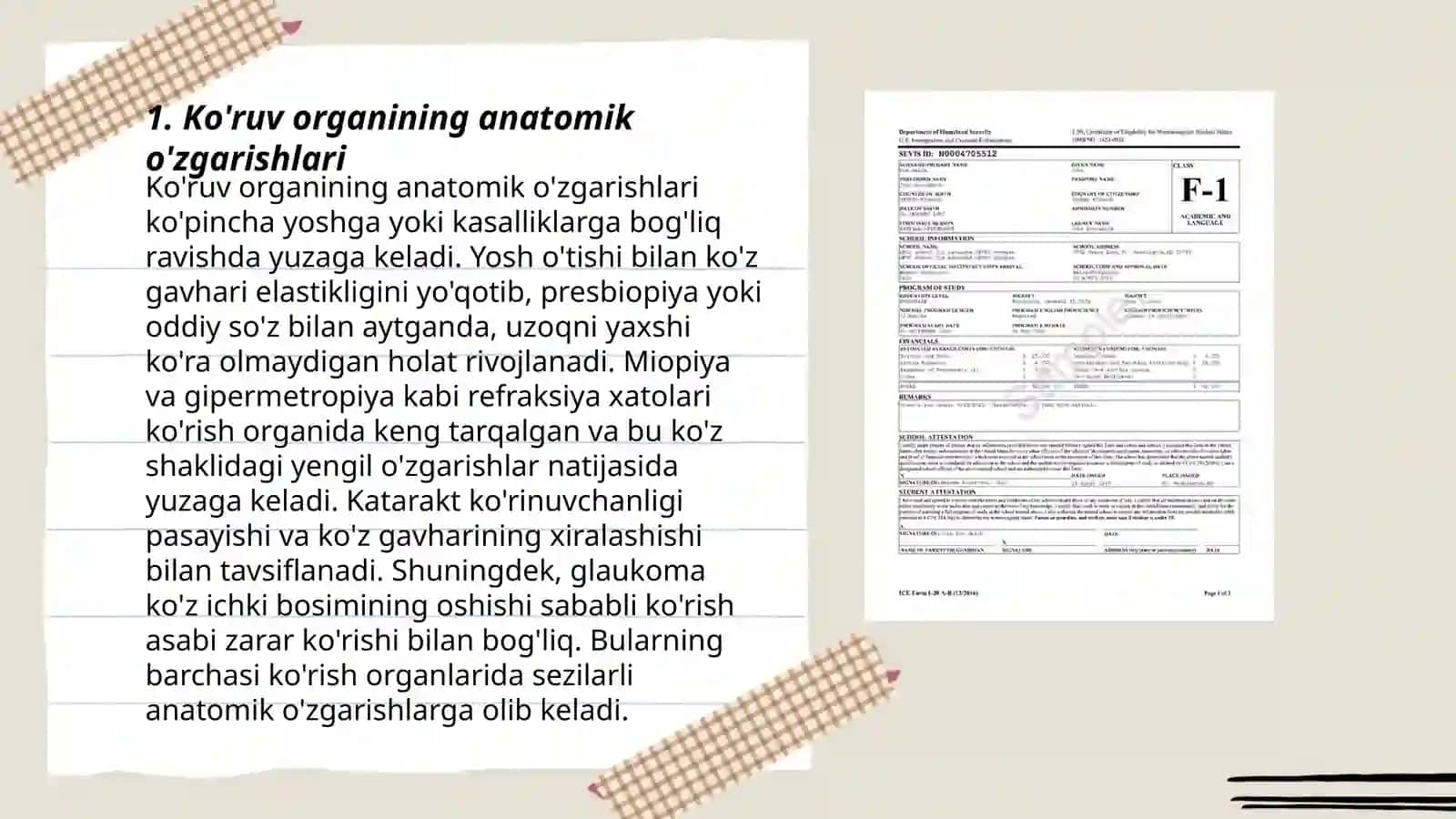 Ko'ruv organining anatomik o'zgarishlari 3