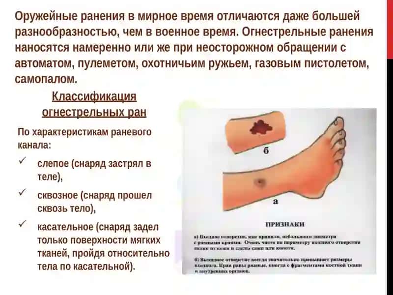 Огнестрельные ранения 3