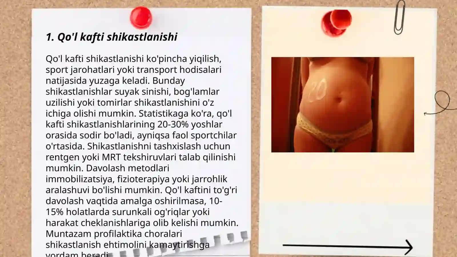 Qo'l kafti shikastlanishi 3