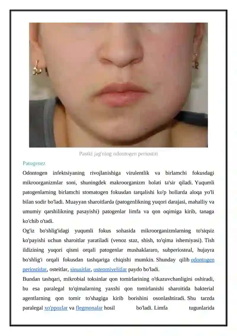 Odontogen infektsiyalar 3