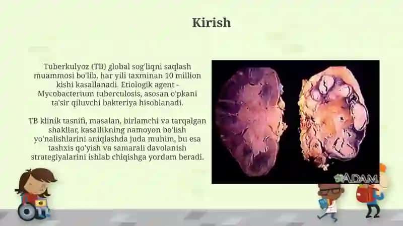 Tuberkulyozning klinik tasnifi 3