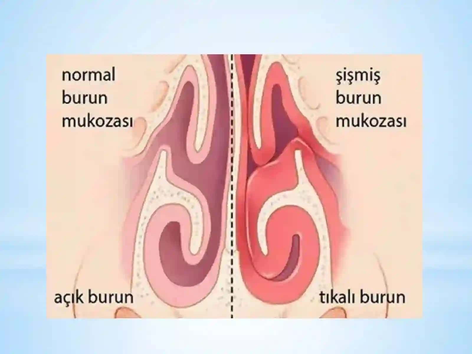 LOR A’ZOLARI SARATON KASALLIKLARI 3