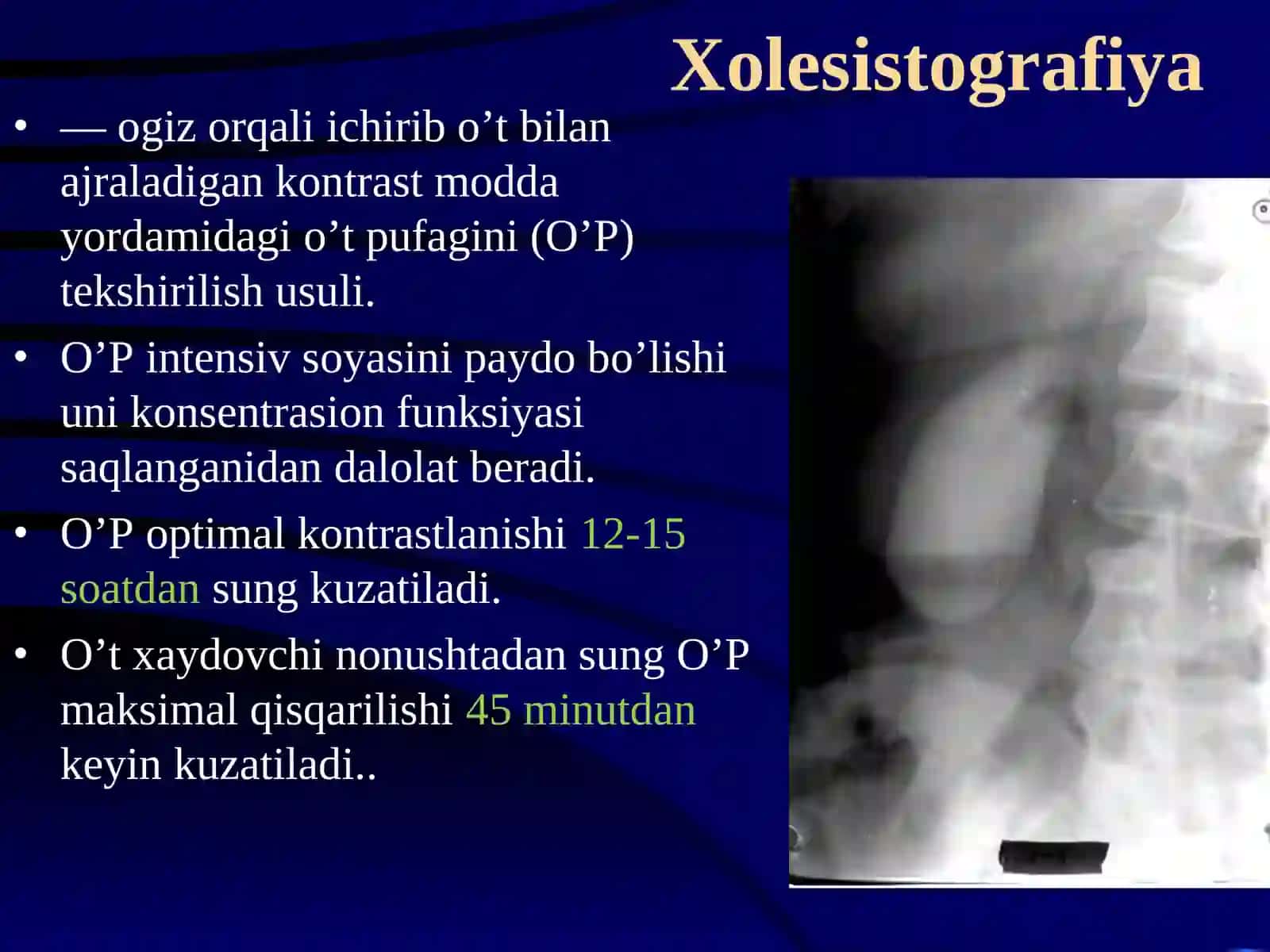 GEPATOBILIAR TIZIMI KASALLIKLARINI 3