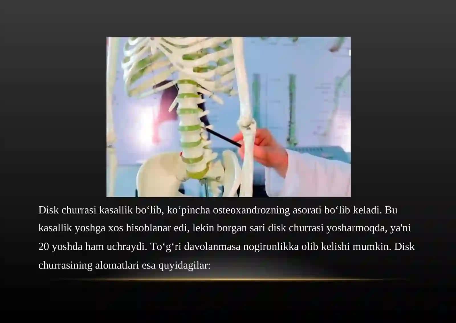 Umurtqa 3