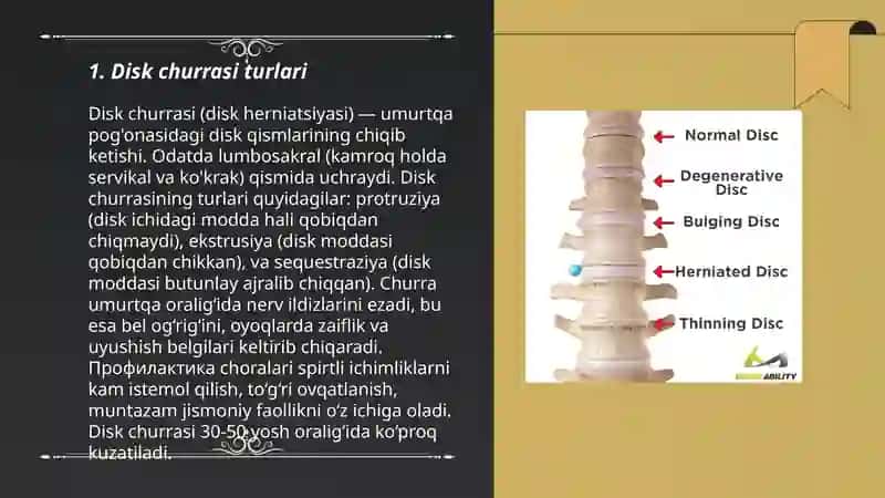 Disk churrasi va unga oid kasalliklar 3