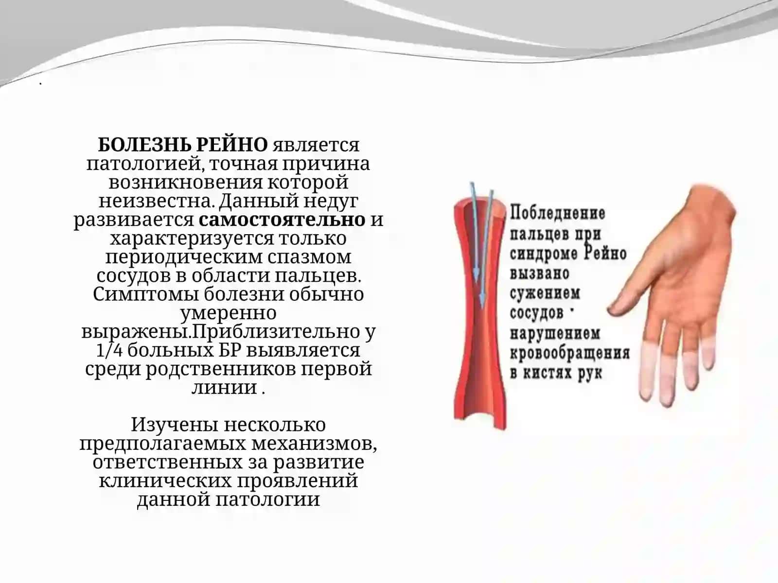 Болезнь Рейно 3