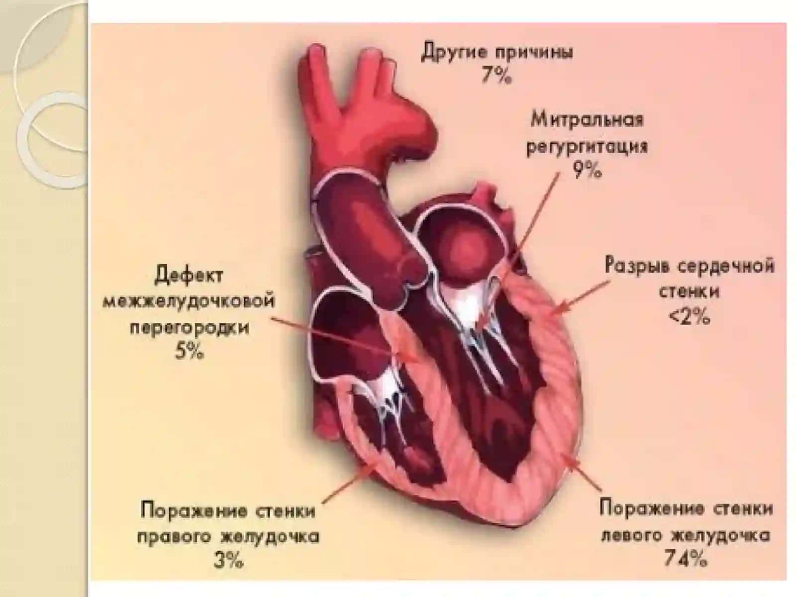 Kardiogens hok klinikasi va davo choralari 3