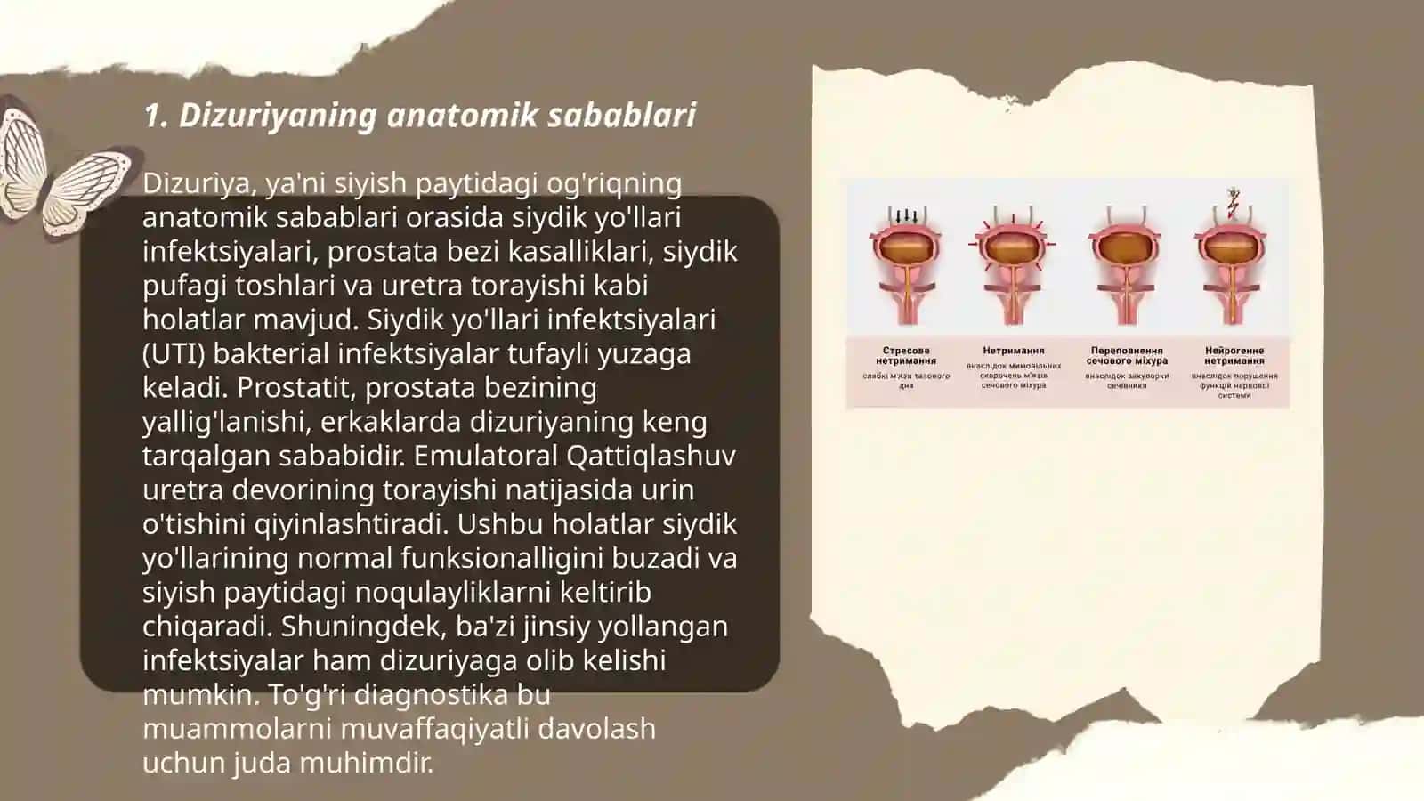 Dizuriyaning sabablari va xavf omillari 3