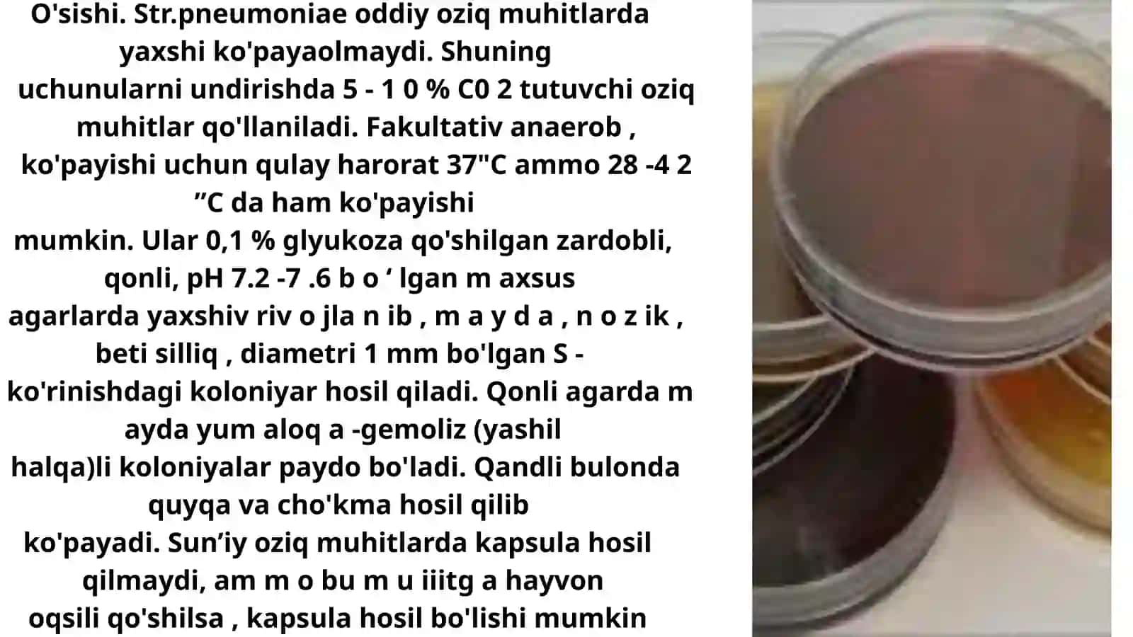 Pnevmokokk, Meningokokk va Haemophilus influenzae 3