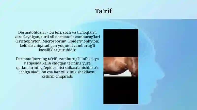 Dermatomikoz qozg’atuvchilari 3
