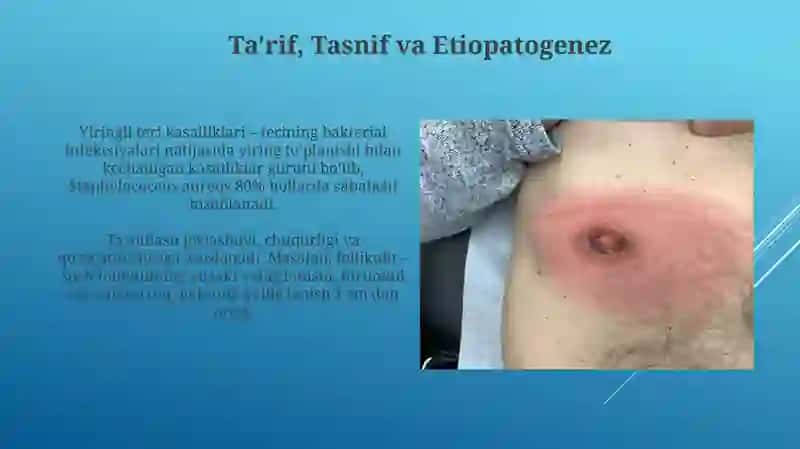 Terining yiringli kasalliklari 3