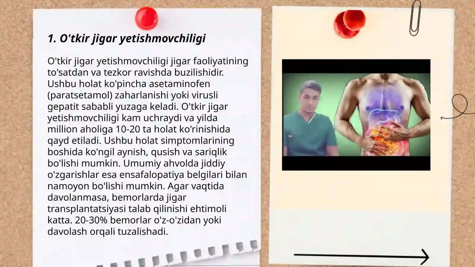 O'tkir jigar yetishmovchiligi 3