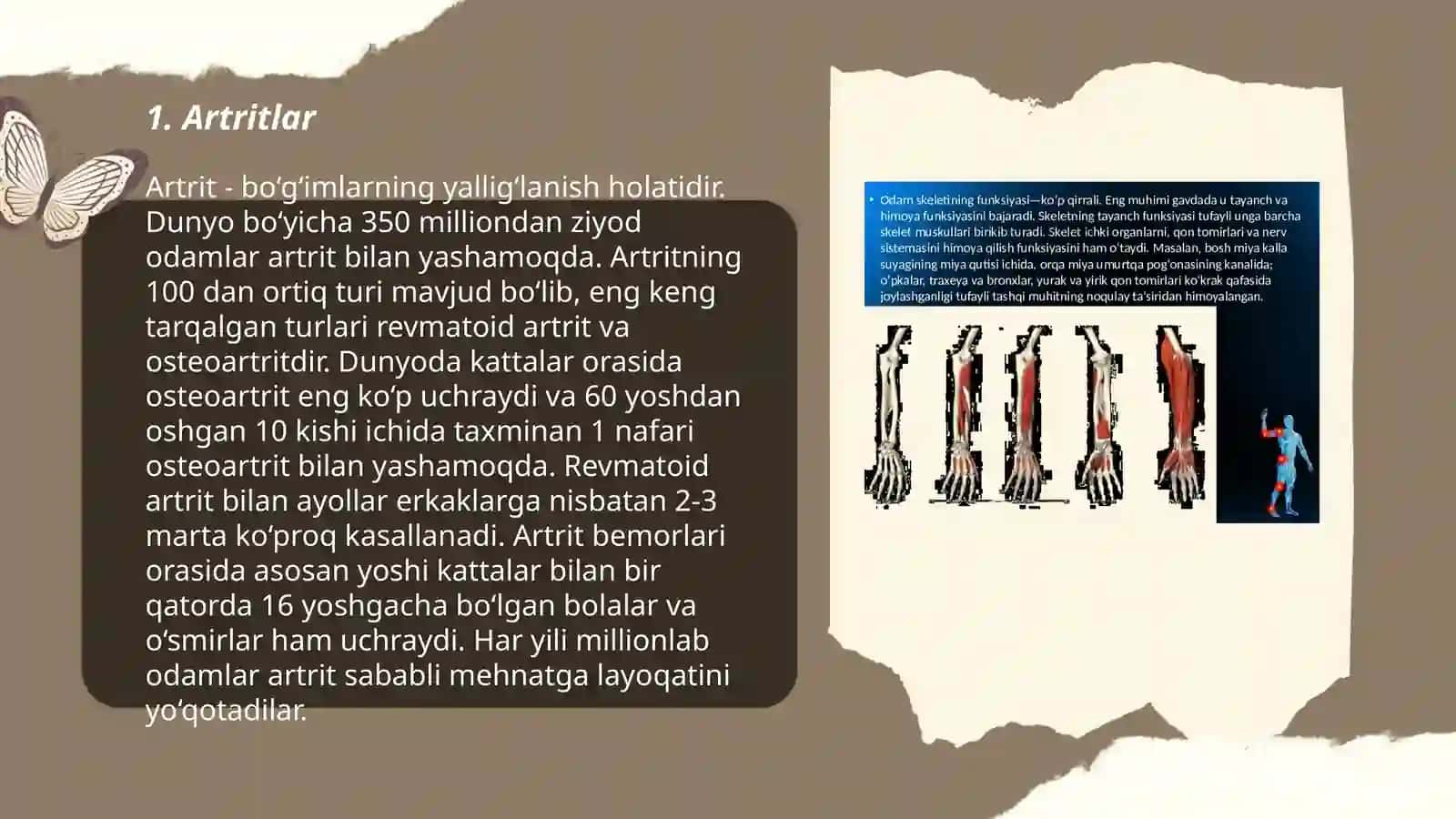 Tayanch harakat apparati patalogiyasining turlari 3