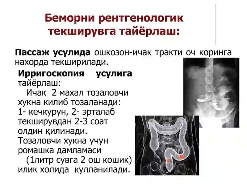 hazm tizimi Рентгенологик текширув усуллари 3