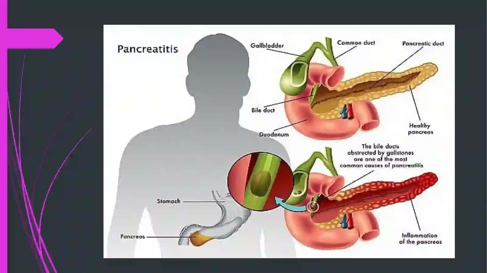 Parsendocrinicapancretis 3