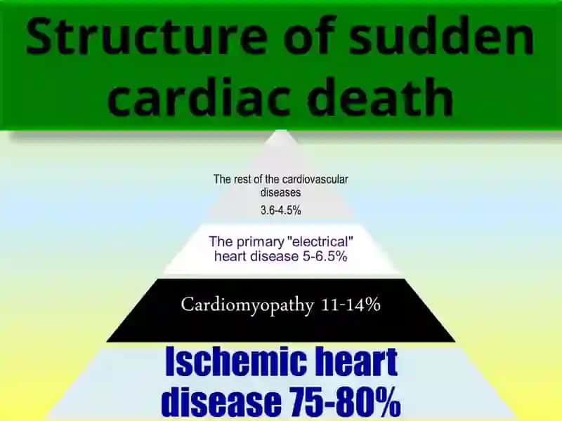 The differential diagnosis of pain in the chest 3