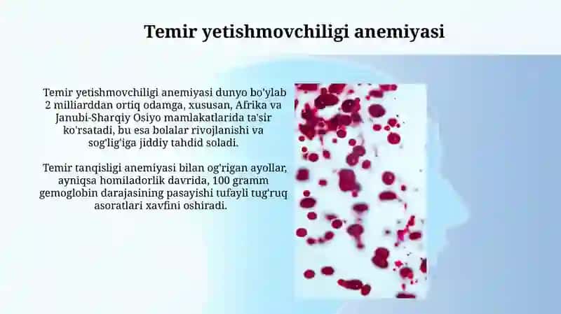 Temir yetishmovchiligi anemiyasi 3