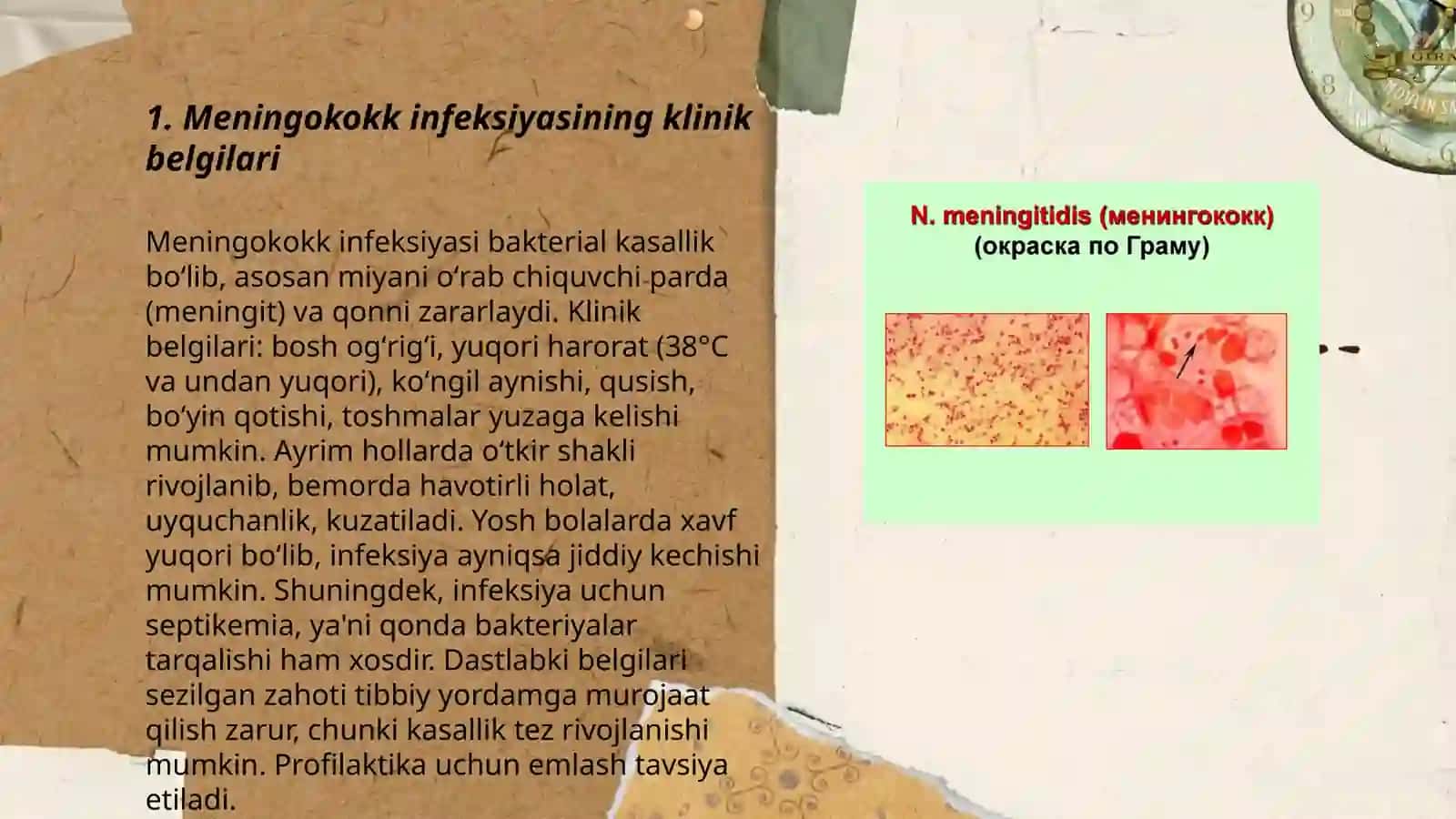 Meningokokk infeksiyasi 3
