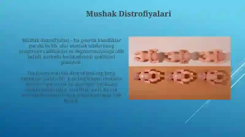Mushak Distrofiyalari 3