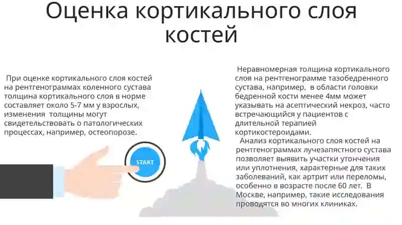 Рентгеноанатомия суставов 3