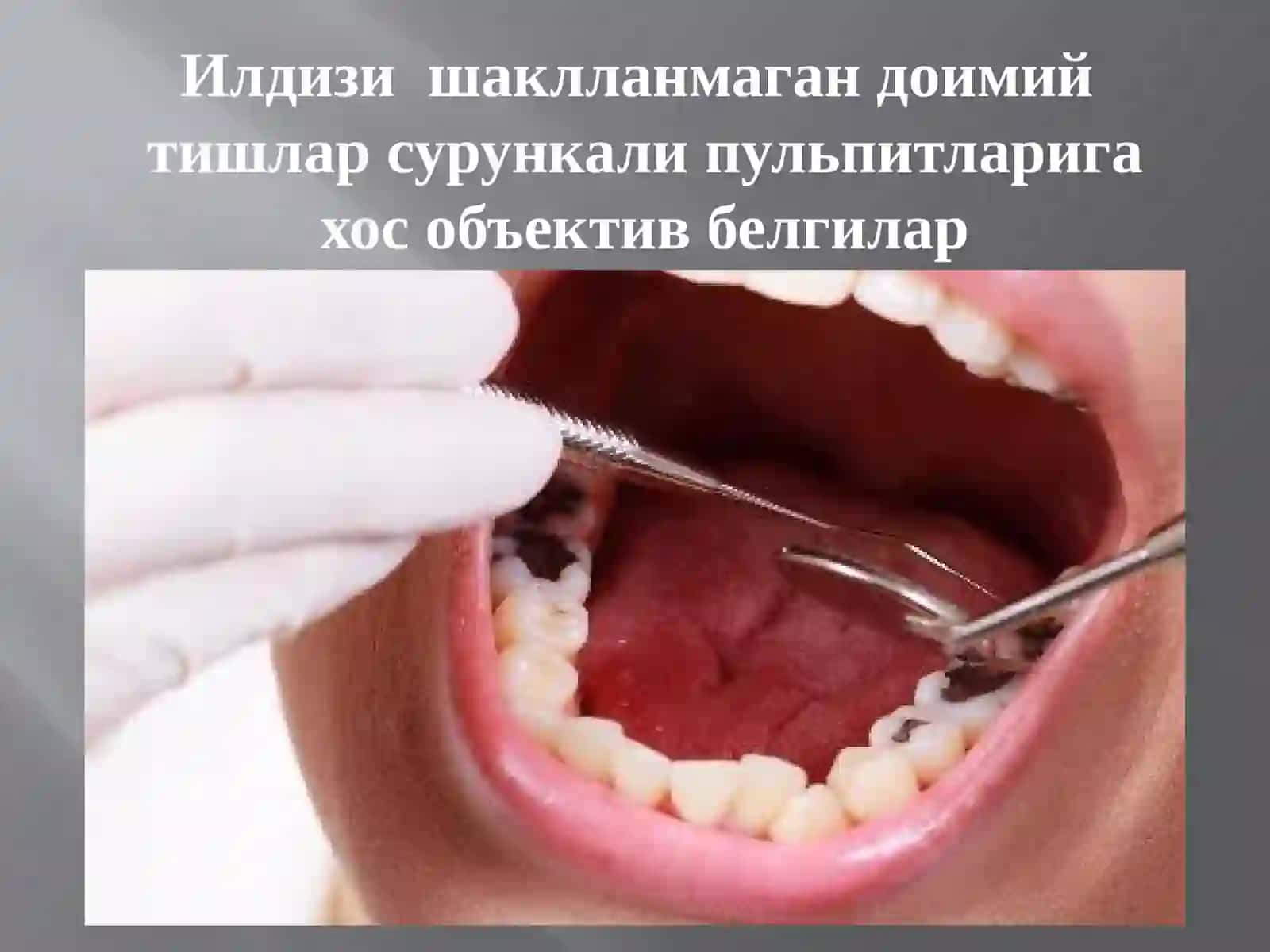 Илдизиш ақлланмаган доимий тишлар 3