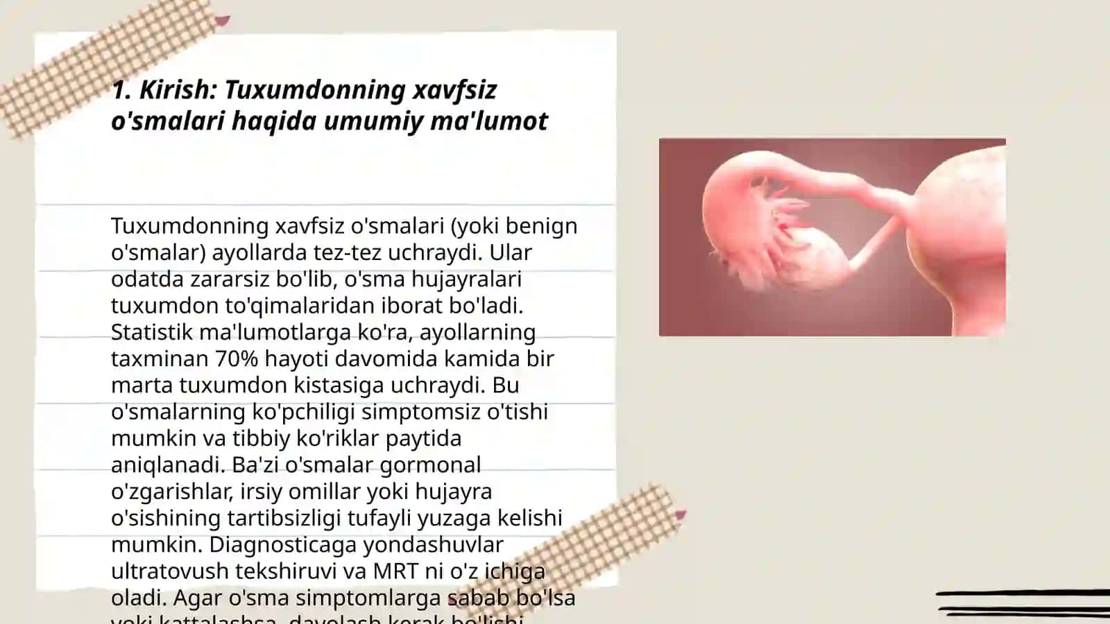 Tuxumdonning xafsiz o'smalari 3