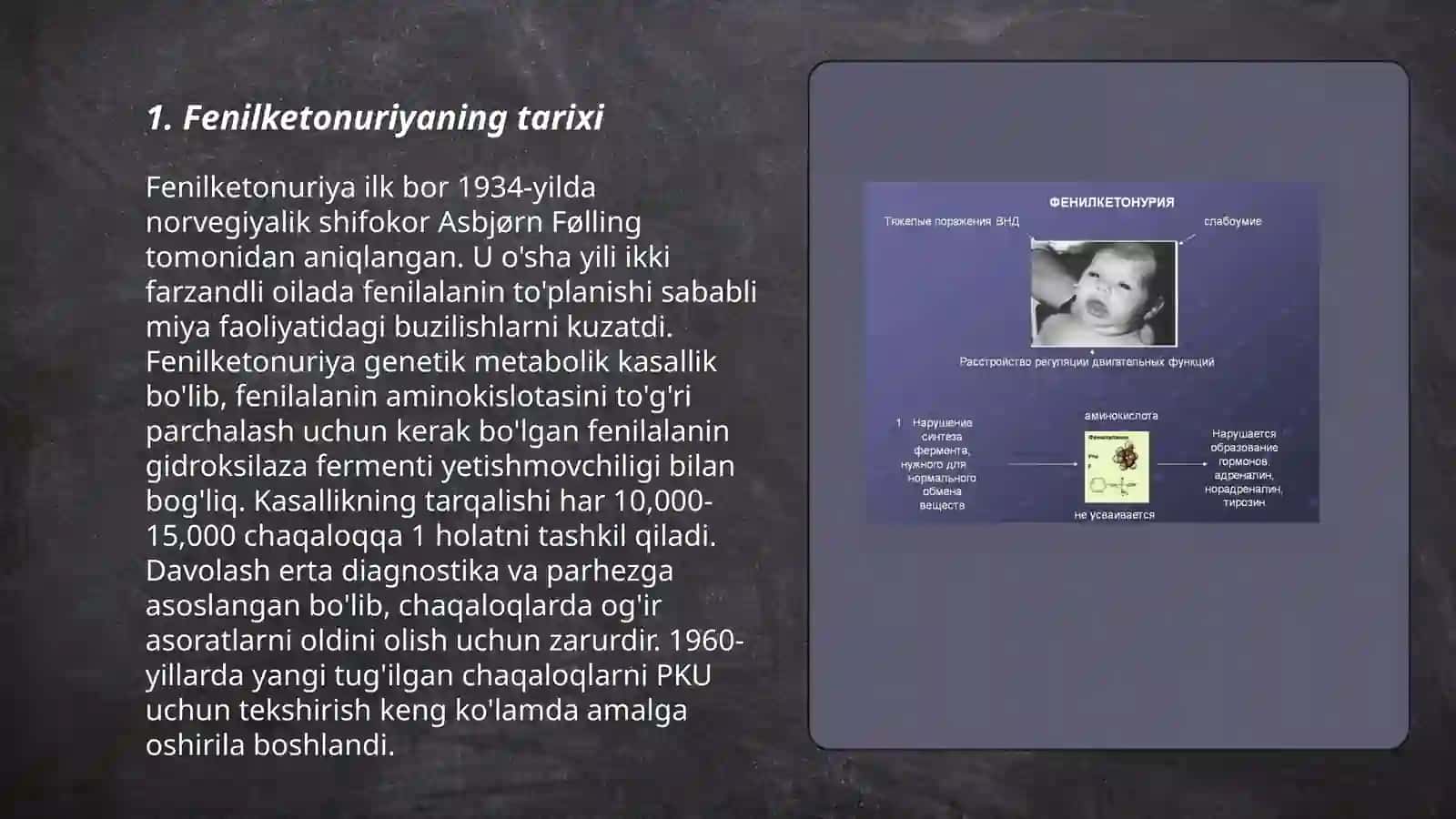 Fenilketonuriya 3