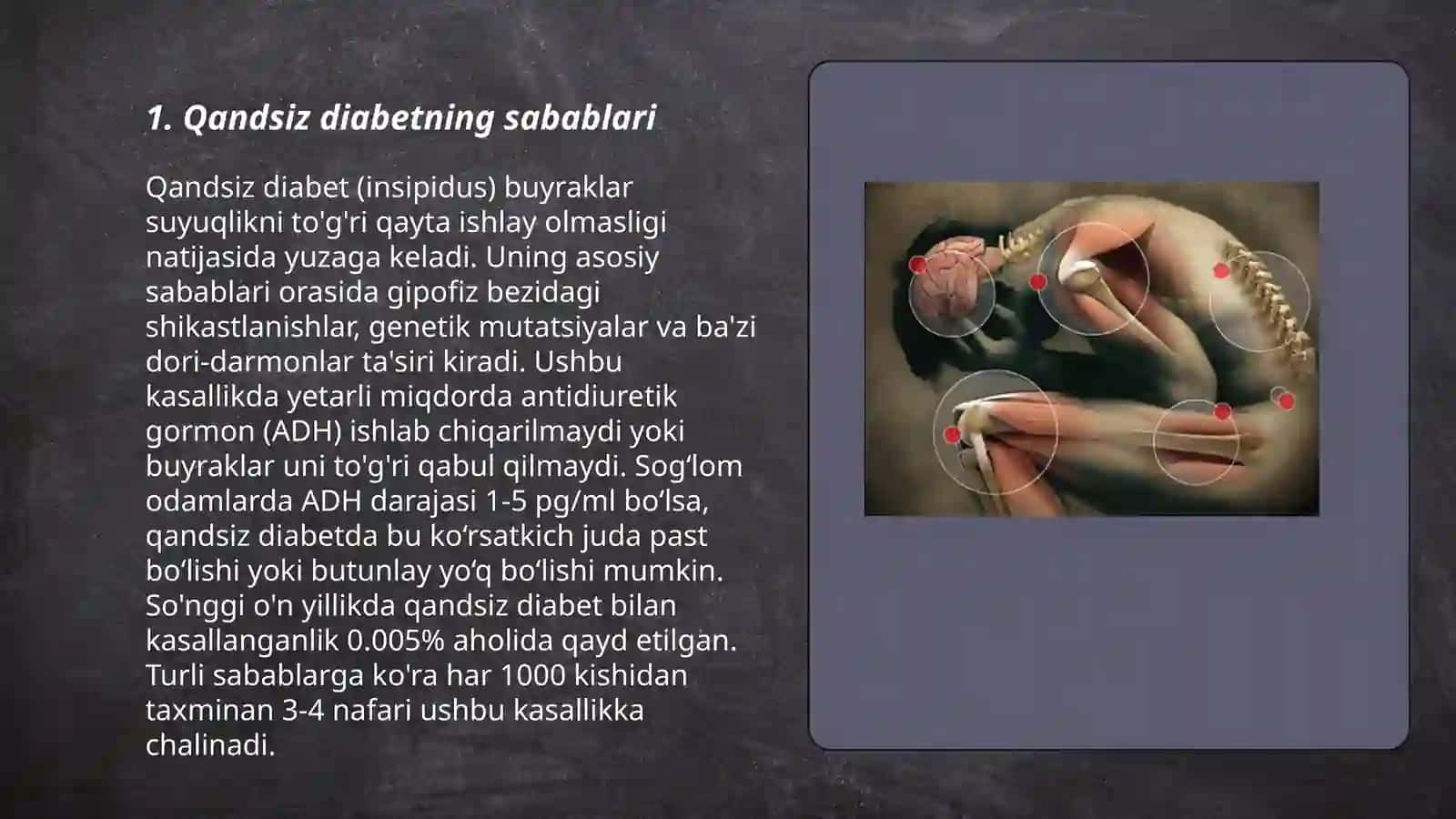 Qandsiz diabet kasalligi haqida 3