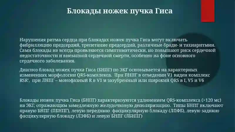 ЭКГ диагностика. Нарушение сердечного ритма 3