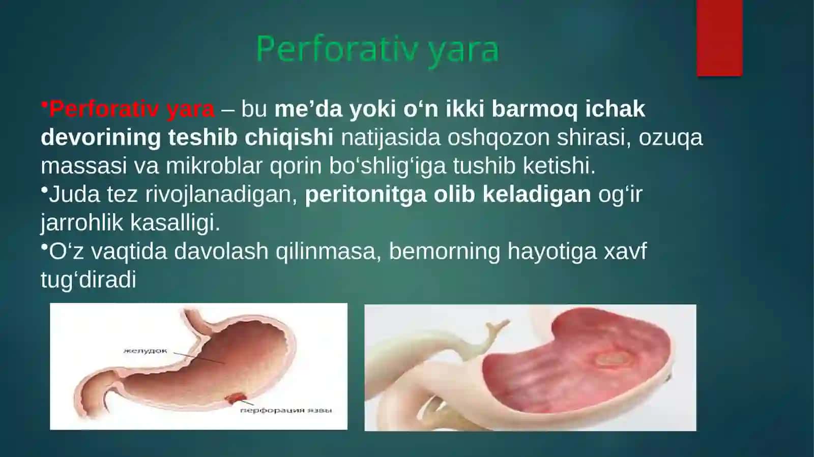 O‘tkir qorinni stimullovchi kasalliklar 3