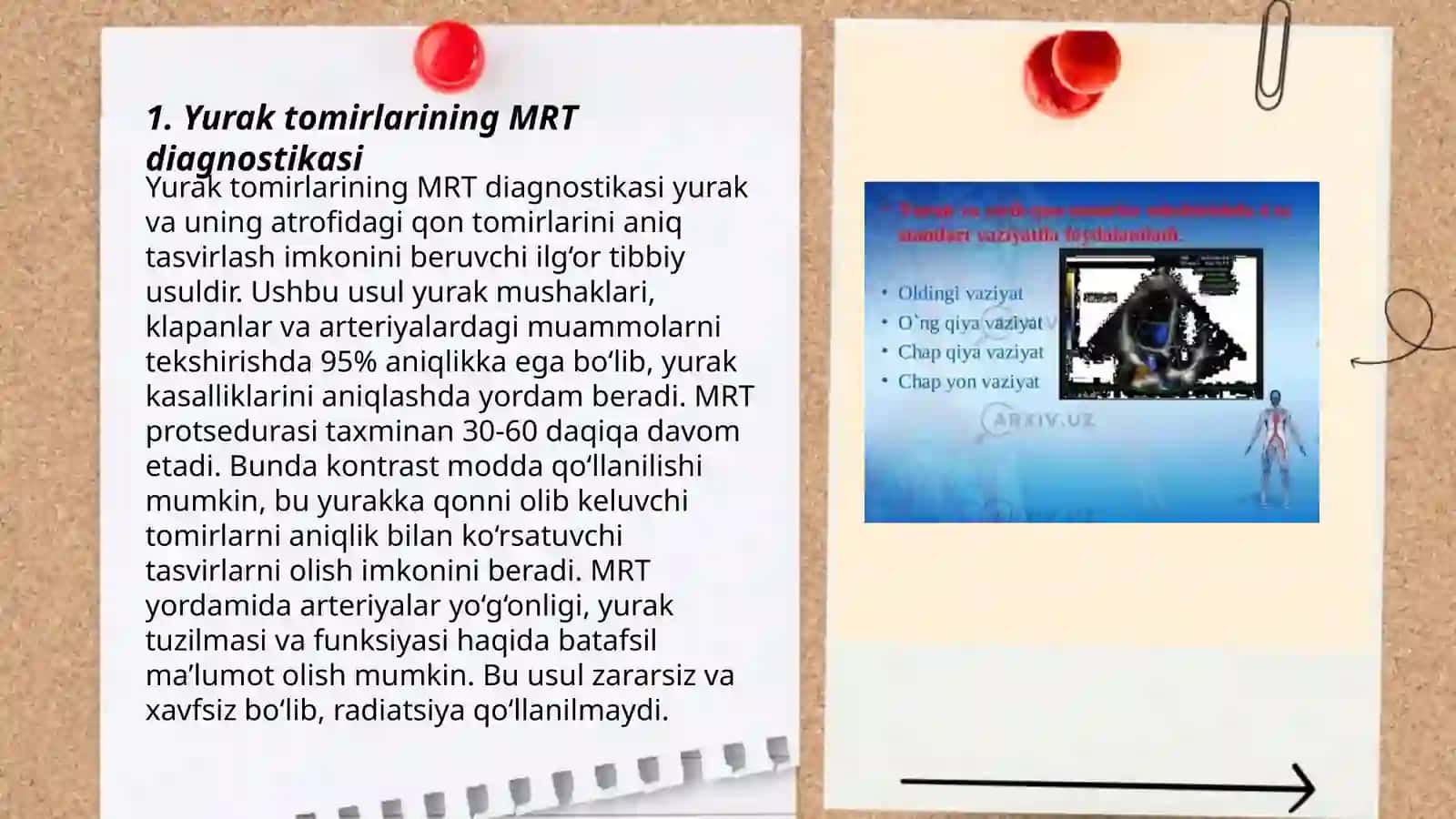 Yurak tomirlari va koʻks oraligʻi organlarining kasalliklarida nur tashxisoti( yurak kasalliklari) MRT. MCT. Rentgen diagnostikasi 3
