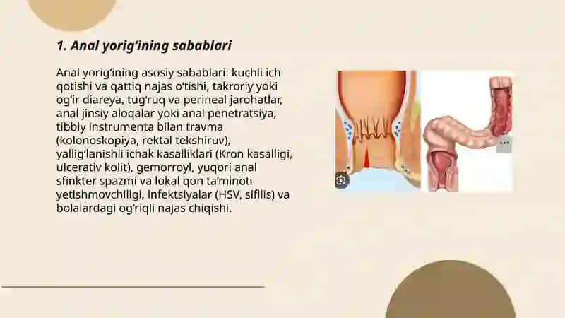 Anal teshigi, Anal yorig‘i 3