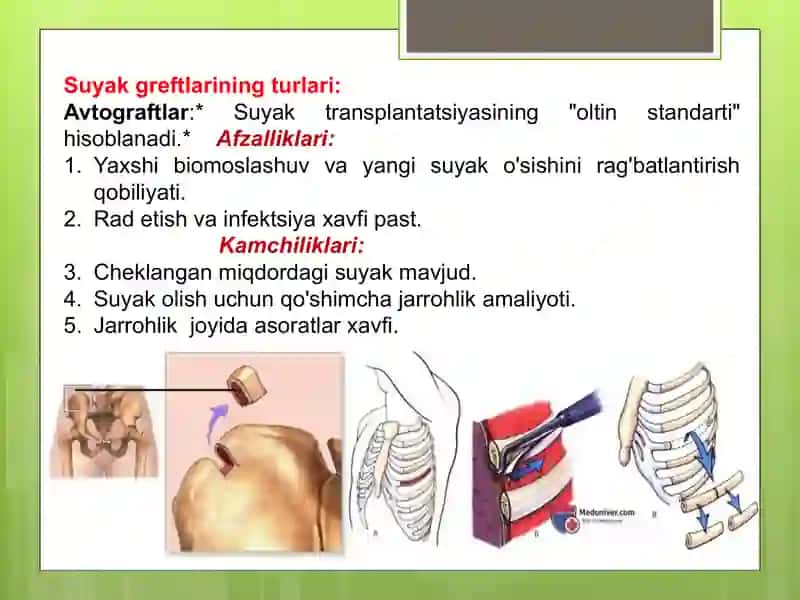 Transplantatlar(suyak transplantatlari) 3