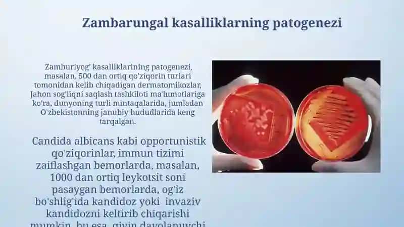 Zamburug'li Kasallik qo'zg'atuvchilar ta'rifi 3