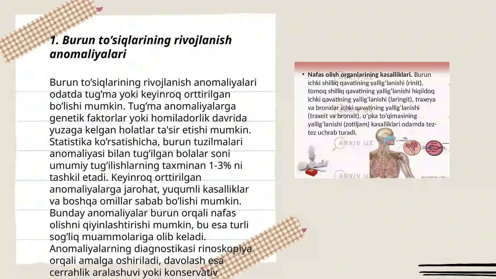 Burun to’siqlarining rivojlanish anomaliyalari 3