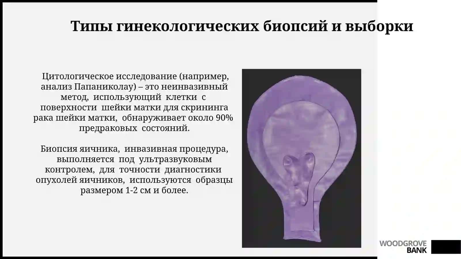 Создание практического руководства по кистам яичников 3
