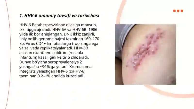 Odamlarda gerpes virusi infeksiyasi 3