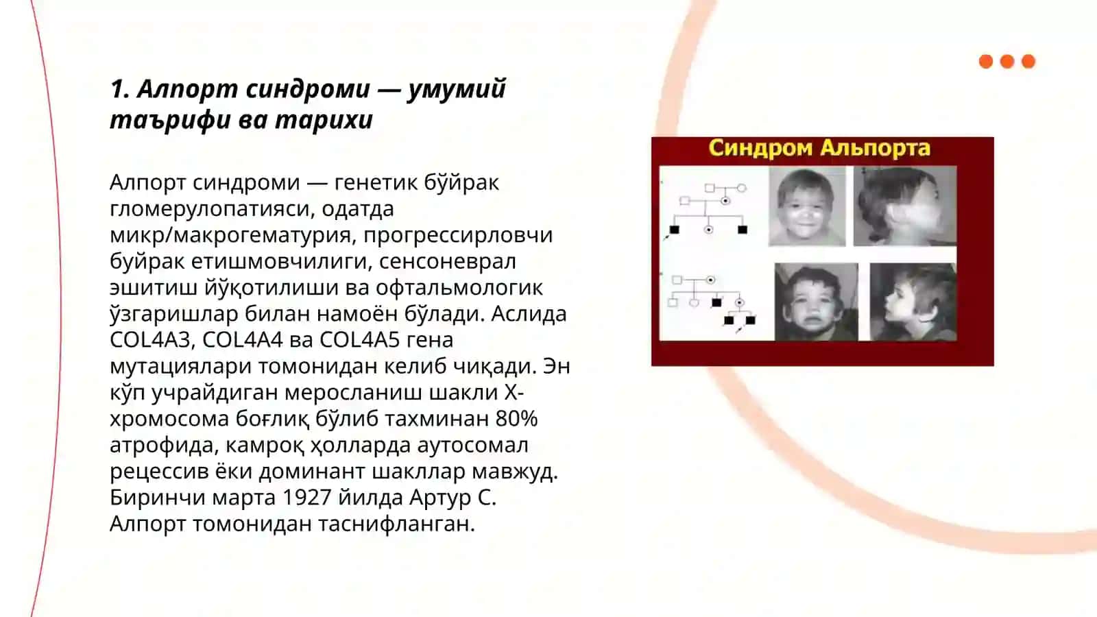 Алпорт синдроми 3