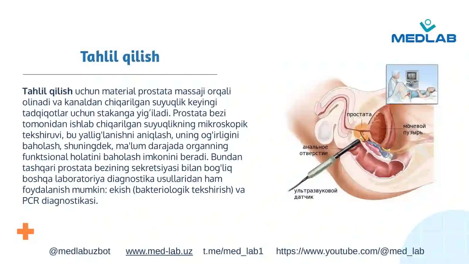 Prostatasekretsiyasi 3