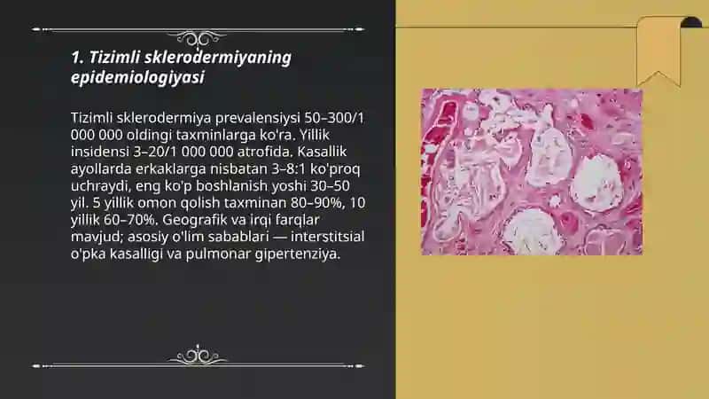 Tizimli sklerodermiya 3