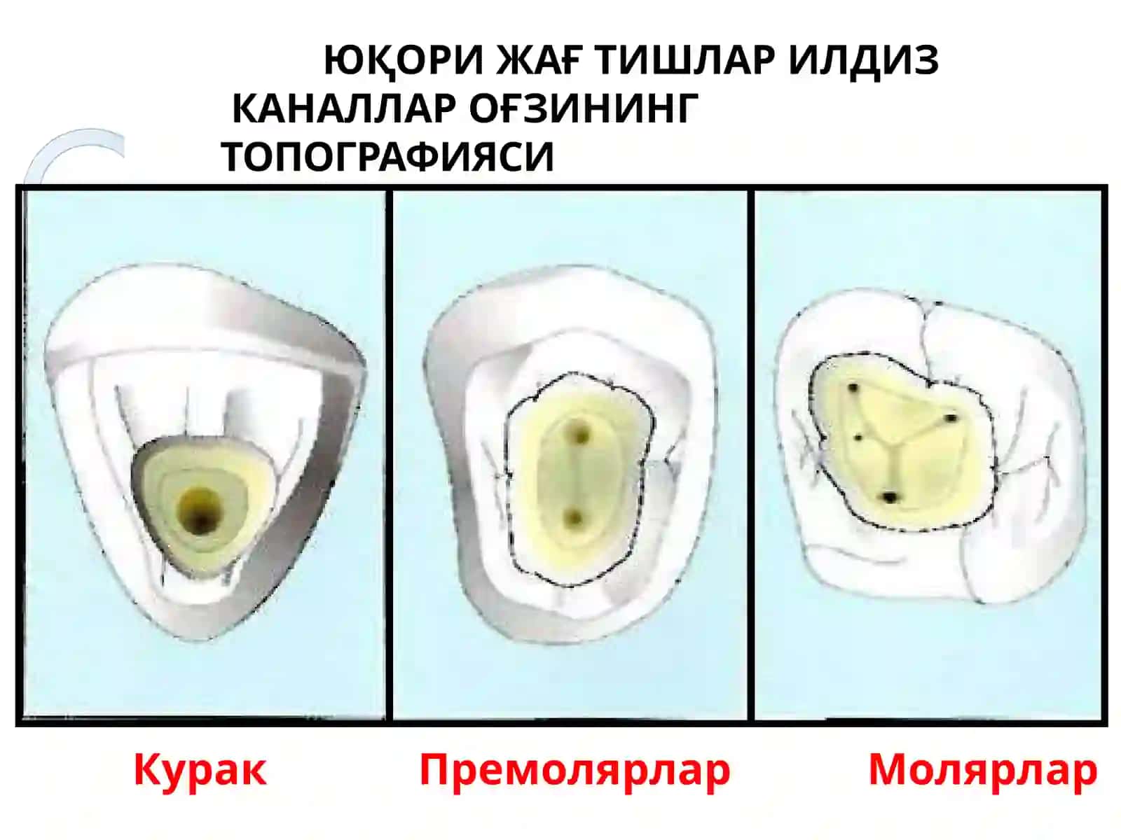 Илдиз каналига асбоблар ёрдамида ишлов бериш 3