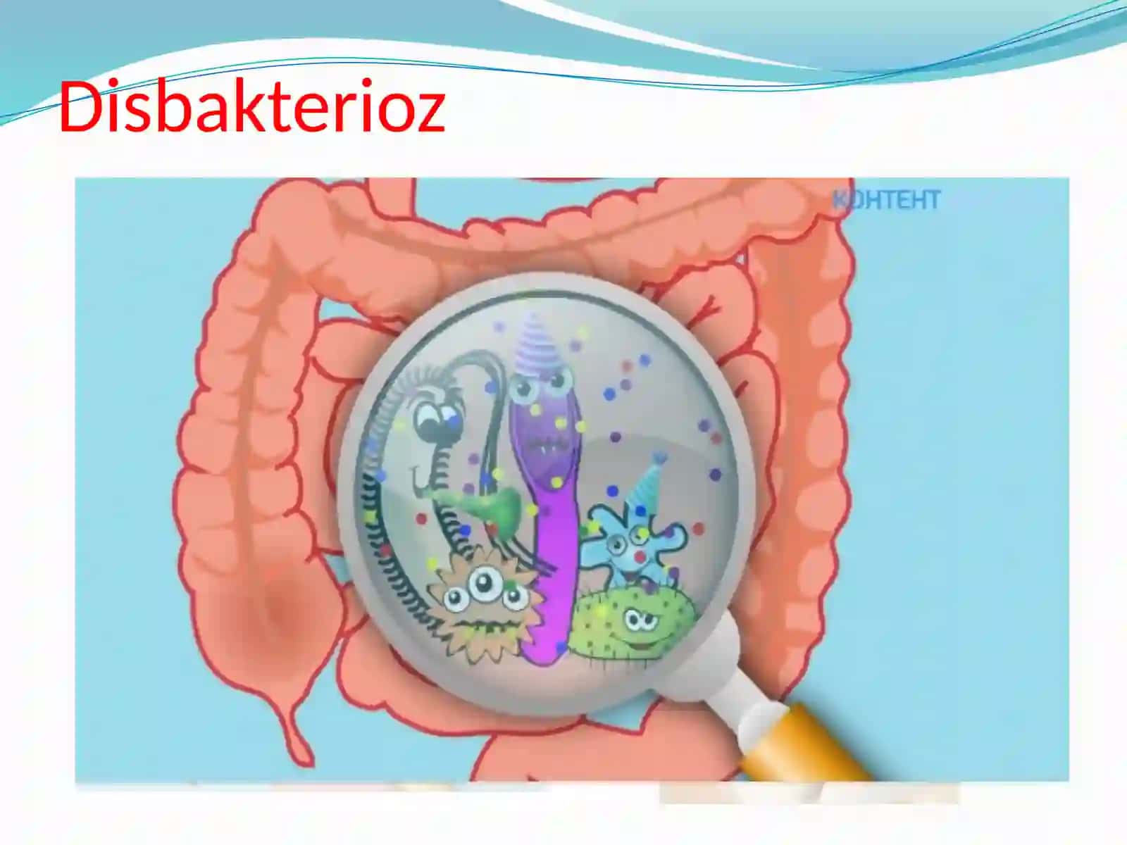Disbakterioz 3