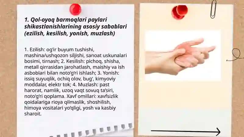 Qol-oyoq barmoqlari paylari shikastlanishlari 3