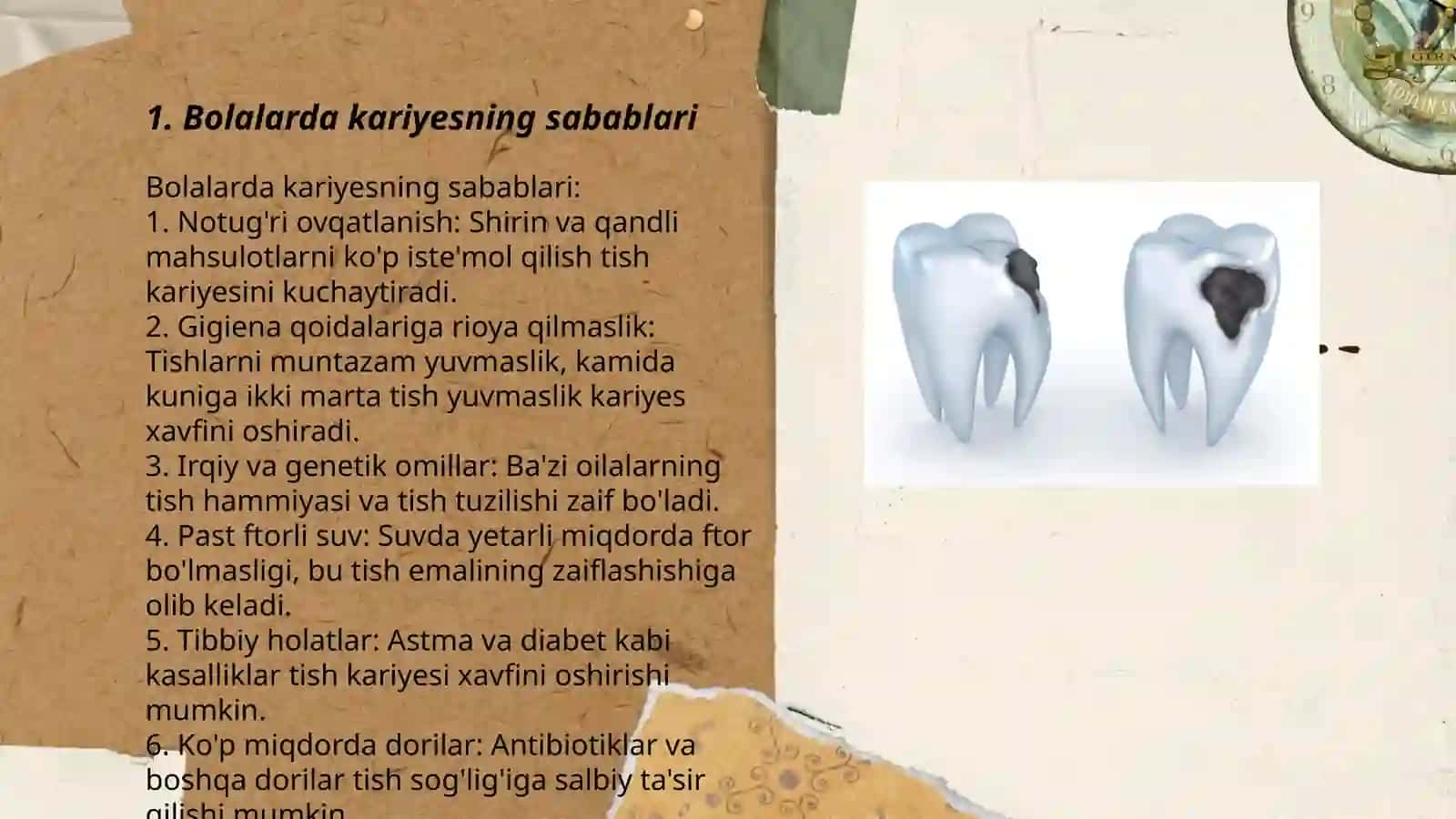 Bolalarda karies 3