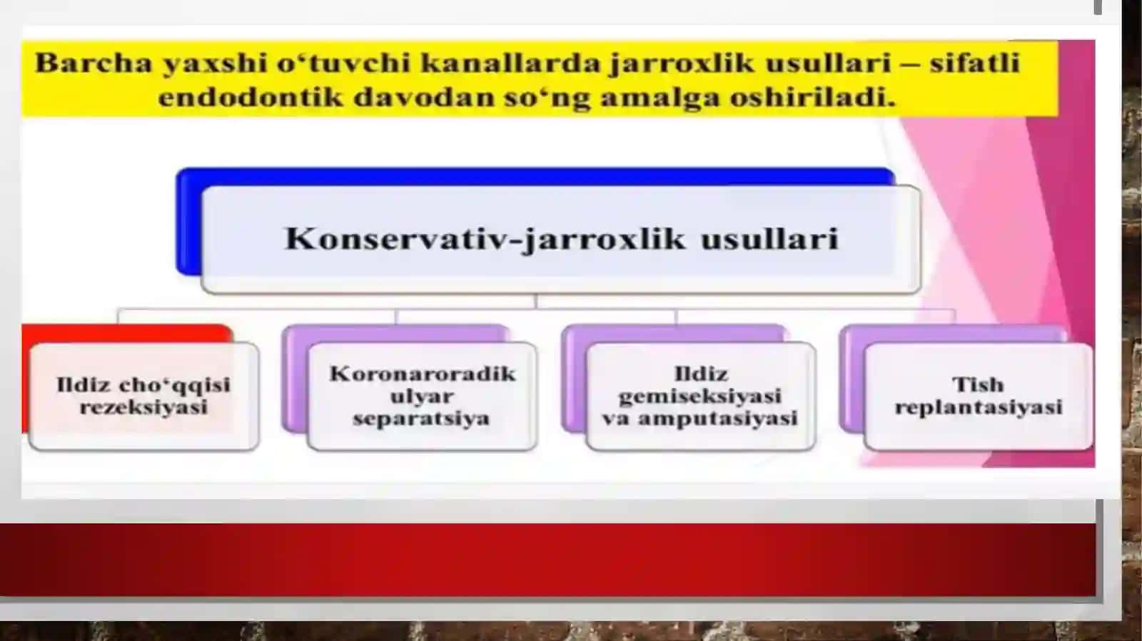 Periodontitni davolash pptx 3