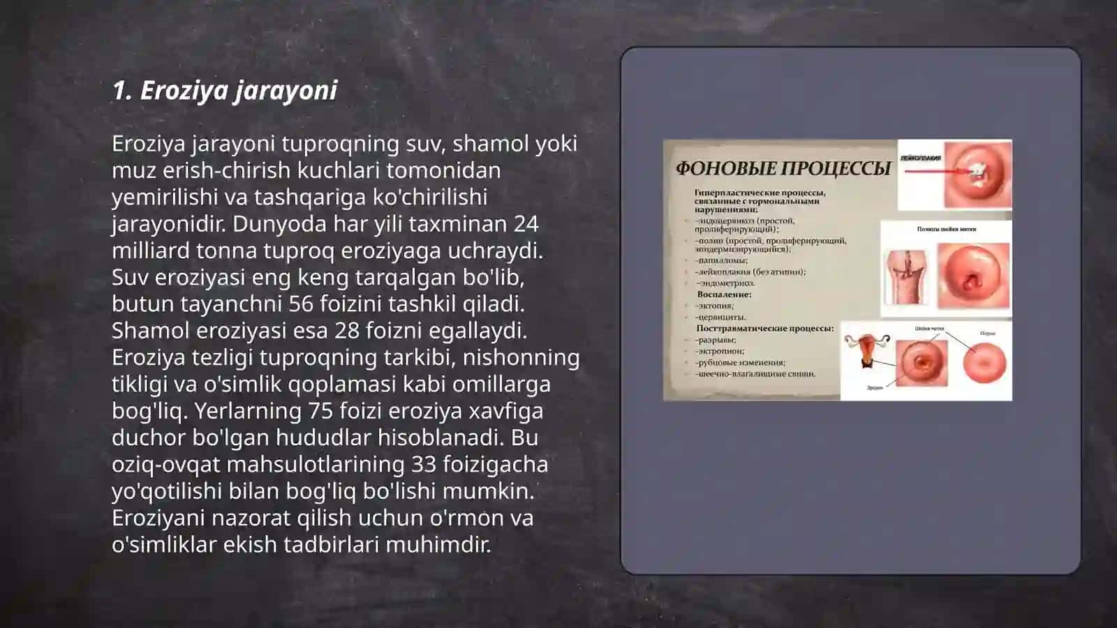 Eroziya 3