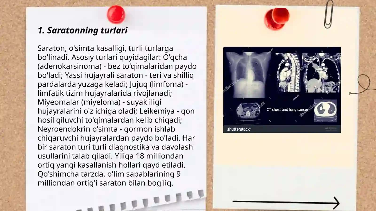 Saraton kasalliga 3