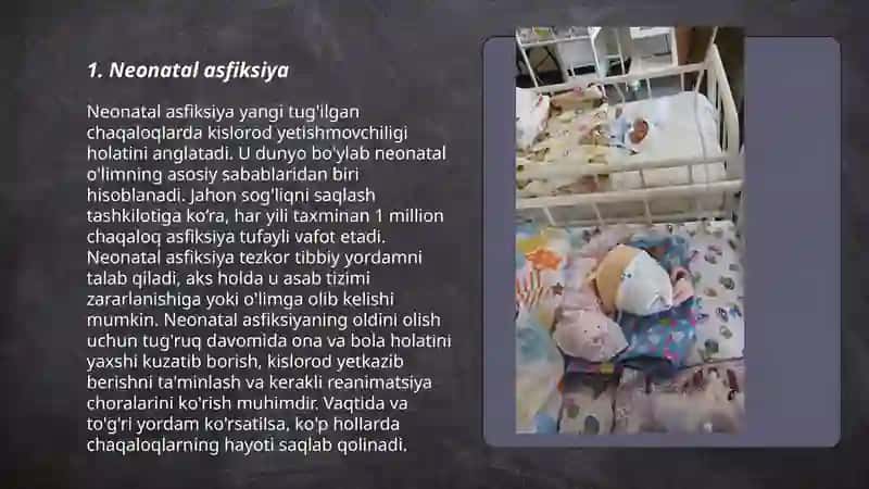 Neonatal asfiksiya 3