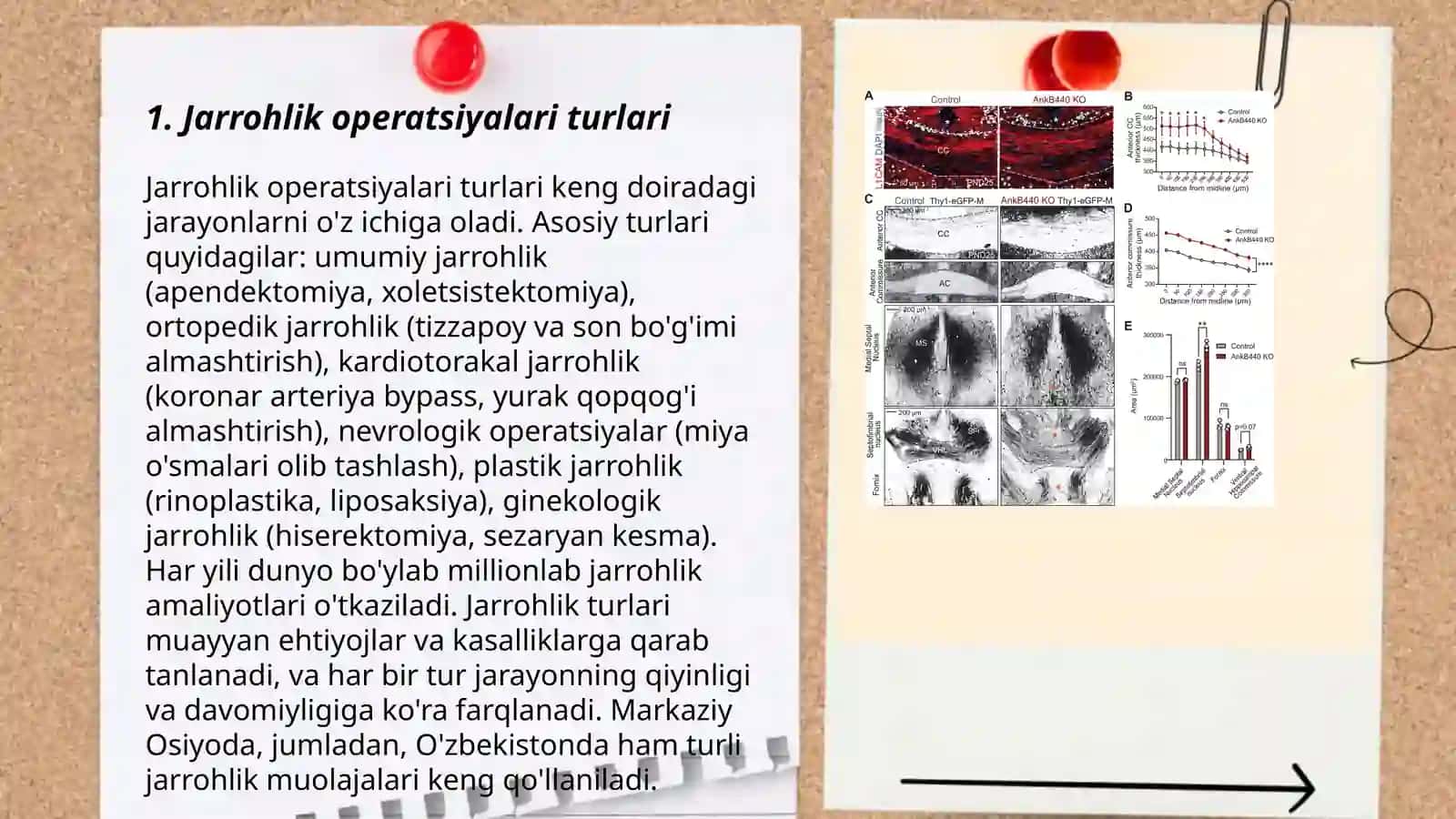 Jarrohlik operatsiyalari turlari 3